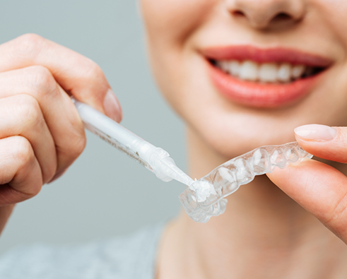 Woman filling tray with whitening gel