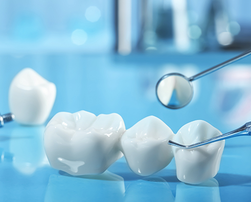 Close up of a dental bridge on blue surface