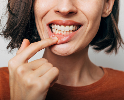 Woman pulling down lip to show gums